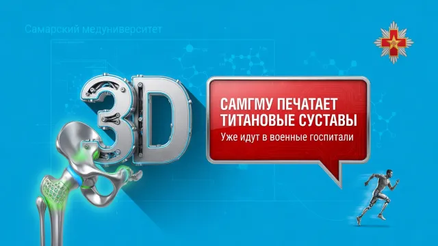 СамГМУ печатает титановые суставы. Уже идут в военные госпитали